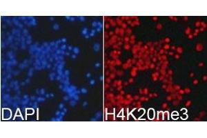 Immunofluorescence analysis of 293T cell using H4K20me3 antibody. (Histone 3 抗体  (3meLys20))