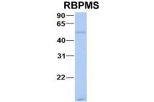 Host:  Rabbit  Target Name:  CHAD  Sample Type:  Human Adult Placenta  Antibody Dilution:  1. (RBPMS 抗体  (N-Term))