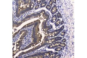 IHC testing of FFPE mouse small intestine tissue with COX4I1 antibody at 1ug/ml. (COX IV 抗体)