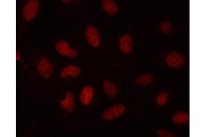 IF analysis of SDE2 using anti-SDE2 antibody (ABIN7599603). (C1orf55 抗体  (AA 10-447))