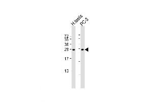 Western Blot at 1:1000 dilution Lane 1: human testis lysate Lane 2: PC-3 whole cell lysate Lysates/proteins at 20 ug per lane. (IL-25 抗体  (AA 76-104))