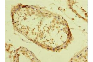 Immunohistochemistry of paraffin-embedded human testis tissue using ABIN7175978 at dilution of 1:100 (ZBTB32 抗体  (AA 1-294))