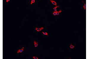ABIN6269244 staining HeLa cells by IF/ICC. (MAP3K8 抗体  (Internal Region))