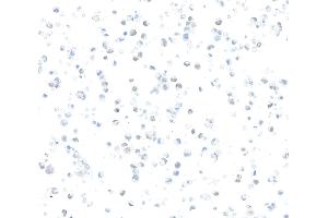 Immunocytochemistry (ICC) image for anti-Zinc Finger E-Box Binding Homeobox 1 (ZEB1) (AA 750-800) antibody (ABIN7455173) (Recombinant ZEB1 抗体  (AA 750-800))