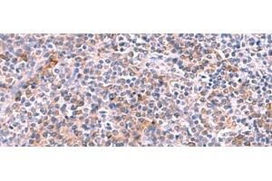 Immunohistochemistry of paraffin-embedded Human tonsil tissue using NCAN Polyclonal Antibody at dilution of 1:30(x200) (Neurocan 抗体)