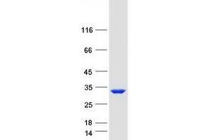 Validation with Western Blot