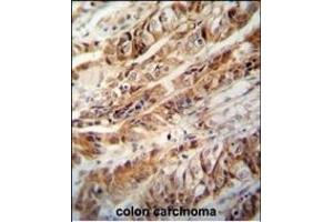 Immunohistochemistry (Paraffin-embedded Sections) (IHC (p)) image for anti-Zinc Finger CCCH-Type Containing 15 (ZC3H15) (AA 367-395), (C-Term) antibody (ABIN654819)