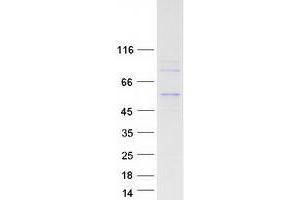 Validation with Western Blot (ADPGK Protein (Transcript Variant 1) (Myc-DYKDDDDK Tag))