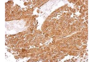 IHC-P Image MRPS5 antibody detects MRPS5 protein at cytosol on AGS xenograft by immunohistochemical analysis. (MRPS5 抗体)