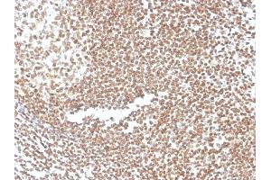 Formalin-fixed, paraffin-embedded human colon stained with P16INK4a Mouse Monoclonal Antibody (CDKN2A/3830). (CDKN2A 抗体)