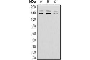 Western blot analysis of BAI1 expression in 293T (A), mouse brain (B), rat brain (C) whole cell lysates. (BAI1 抗体)