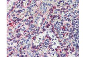 IHC Information: Spleen, Human: Formalin-Fixed, Paraffin-Embedded (FFPE) (CYBB 抗体  (C-Term))
