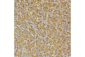 Immunohistochemistry (IHC) image for anti-phosphoribosyl Pyrophosphate Synthetase-Associated Protein 2 (PRPSAP2) (AA 1-90) antibody (ABIN7269365)