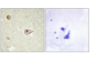 Immunohistochemistry (IHC) image for anti-Cytochrome P450, Family 19, Subfamily A, Polypeptide 1 (CYP19A1) antibody (ABIN1850332) (Aromatase 抗体)
