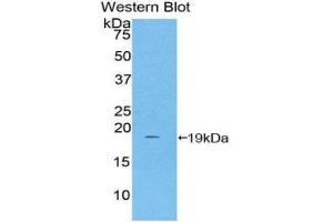 Western Blotting (WB) image for anti-Haptoglobin (HP) (AA 168-319) antibody (ABIN1859196) (Haptoglobin 抗体  (AA 168-319))