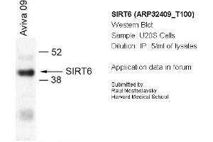 Image no. 1 for anti-Sirtuin 6 (SIRT6) (N-Term) antibody (ABIN2779625) (SIRT6 抗体  (N-Term))