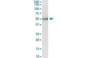 KRT83 MaxPab rabbit polyclonal antibody. (KRT83 抗体  (AA 1-493))