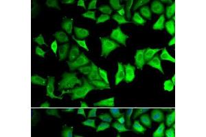 Immunofluorescence analysis of MCF-7 cells using RPS12 Polyclonal Antibody (RPS12 抗体)