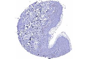 Immunohistochemistry (IHC) image for anti-Tumor Protein P53 (TP53) antibody (ABIN7477547)