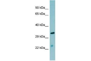 WB Suggested Anti-MASP2  Antibody Titration: 0. (MASP2 抗体  (N-Term))
