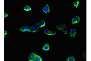 Immunofluorescent analysis of HepG2 cells using ABIN7148593 at dilution of 1:100 and Alexa Fluor 488-congugated AffiniPure Goat Anti-Rabbit IgG(H+L) (Coronin 1a 抗体  (AA 363-432))