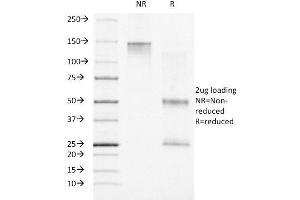SDS-PAGE Analysis Purified Progesterone Receptor Mouse Monoclonal Antibody (PR500). (Progesterone Receptor 抗体)