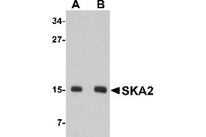 Western blot analysis of SKA2 in 3T3 cell lysate with SKA2 antibody at (A) 0. (FAM33A 抗体  (N-Term))