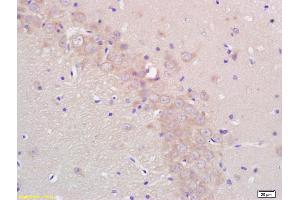 Immunohistochemistry (IHC) image for anti-Cytochrome P450, Family 19, Subfamily A, Polypeptide 1 (CYP19A1) (AA 41-140) antibody (ABIN674529)