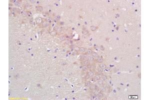 Formalin-fixed and paraffin embedded rat brain labeled with Rabbit Anti CYP19/CYP19A1 Polyclonal Antibody, Unconjugated (ABIN674529) at 1:200 followed by conjugation to the secondary antibody and DAB staining (Aromatase 抗体  (AA 41-140))