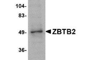 Image no. 1 for anti-Zinc Finger and BTB Domain Containing 2 (ZBTB2) (Internal Region) antibody (ABIN341715) (ZBTB2 抗体  (Internal Region))