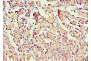 Immunohistochemistry of paraffin-embedded human pancreatic tissue using ABIN7155744 at dilution of 1:100 (HOXB7 抗体  (AA 1-120))