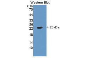 Western blot analysis of recombinant Human RBP4. (RBP4 抗体  (AA 18-201))