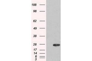 Image no. 1 for anti-Adenylate Kinase 1 (AK1) antibody (ABIN1496515) (Adenylate Kinase 1 抗体)