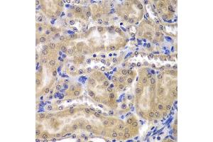 Immunohistochemistry of paraffin-embedded mouse kidney using RPL5 antibody (ABIN3015785, ABIN3015786, ABIN3015787 and ABIN6219135) at dilution of 1:200 (40x lens). (RPL5 抗体  (AA 1-95))