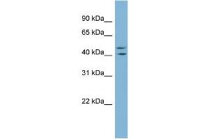 WB Suggested Anti-ZNF517 Antibody Titration:  0. (ZNF517 抗体  (Middle Region))