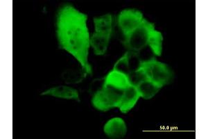 Immunofluorescence of monoclonal antibody to S100A2 on A-431 cell. (S100A2 抗体  (AA 1-97))