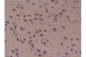 Detection of Cys-C in Mouse Cerebrum Tissue using Polyclonal Antibody to Cystatin C (Cys-C) (CST3 抗体  (AA 21-140))