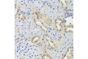Immunohistochemistry of paraffin-embedded rat kidney using CTSC antibody at dilution of 1:100 (x40 lens). (CTSC 抗体)