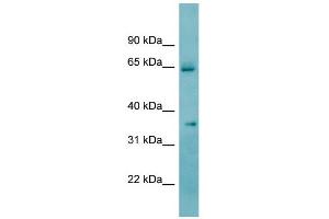 WB Suggested Anti-KHK Antibody Titration:  0. (Ketohexokinase 抗体  (N-Term))