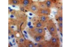 Used in DAB staining on fromalin fixed paraffin-embedded Liver tissue (IFNA21 抗体  (AA 25-189))