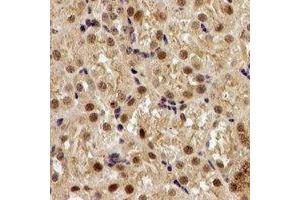 Immunohistochemical analysis of EGLN1 staining in human kidney formalin fixed paraffin embedded tissue section. (EGLN1 抗体)