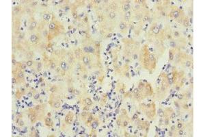 Immunohistochemistry (IHC) image for anti-Protein tyrosine Phosphatase, Non-Receptor Type 7 (PTPN7) (AA 1-190) antibody (ABIN7174120)
