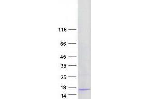 Western Blotting (WB) image for Costars family protein ABRACL (ABRACL) protein (Myc-DYKDDDDK Tag) (ABIN2715536)