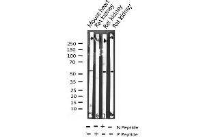 Western blot analysis of Phospho-ATF2 (Ser112 or 94) expression in various lysates (ATF2 抗体  (pSer94, pSer112))