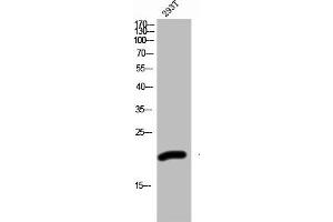 Western Blot analysis of 293T cells using ZNF695 Polyclonal Antibody (ZNF695 抗体  (Internal Region))