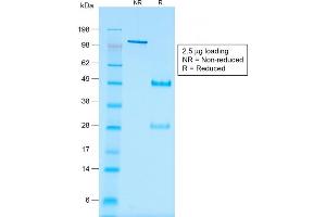 SDS-PAGE Analysis of Purified WT1 Mouse Recombinant Monoclonal Antibody ABIN6383829. (Recombinant WT1 抗体)