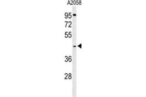 Western Blotting (WB) image for anti-Trans-2,3-Enoyl-CoA Reductase (TECR) antibody (ABIN3004322) (TECR 抗体)