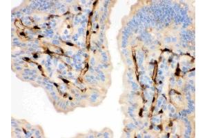 IHC analysis of FABP4 using anti-FABP4 antibody (ABIN3043827).