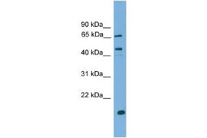 WB Suggested Anti-DNAJA2 Antibody Titration: 0. (DNAJA2 抗体  (N-Term))