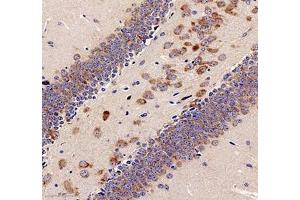 Immunohistochemistry analysis of paraffin-embedded mouse testis using TESK1 (ABIN7075866)at dilution of 1: 500 (TESK1 抗体)